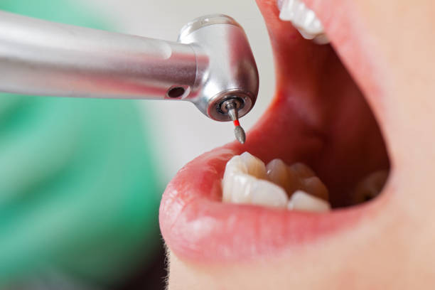 Best Urgent Care for Lost Fillings or Crowns in Aurora, NE